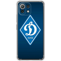 Чохол-накладка (панель) на Xiaomi Mi 11 Lite Динамо Київ  (EDP-5853sp-2281)