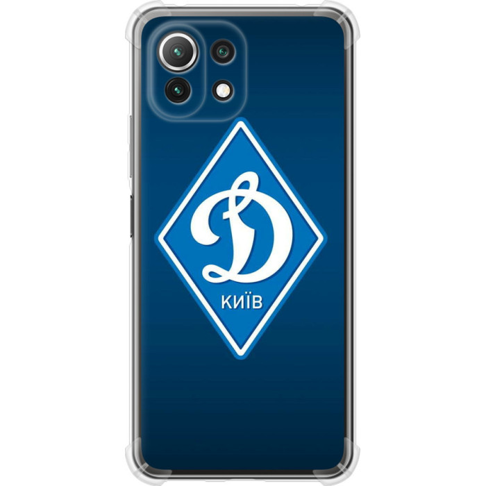 Чехол на Xiaomi Mi 11 Lite Динамо Киев 