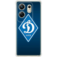 Чохол-накладка (панель) на Infinix Zero 30 4G Динамо Київ  (EDP-5853sp-3413)
