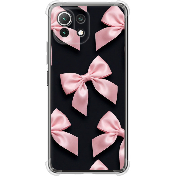 Чехол на Xiaomi Mi 11 Lite Coquette Ribbons Dark Coquette 